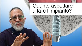 Impianto dentale quanto aspettare dopo lestrazione [upl. by Annaet853]