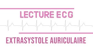 Interprétation ECG  Extrasystole Auriculaire quotESAquot [upl. by Ohcirej576]