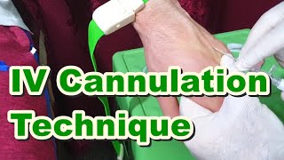 How to Insert IV Cannula  IV Cannulation Technique  Branula  Intravenous Catheter [upl. by Billi]