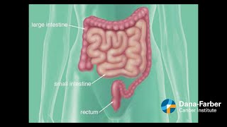 OPEN RIGHT HEMICOLECTOMY STEP BY STEP OPERATIVE SURGERY [upl. by Combs]