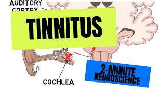 2Minute Neuroscience Tinnitus [upl. by Eckhardt]