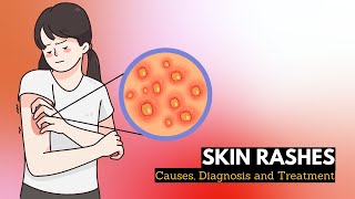 Skin Rash Causes Signs and Symptoms Diagnosis and Treatment [upl. by Aizan]