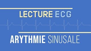 Interprétation ECG  Arythmie Sinusale [upl. by Elik620]